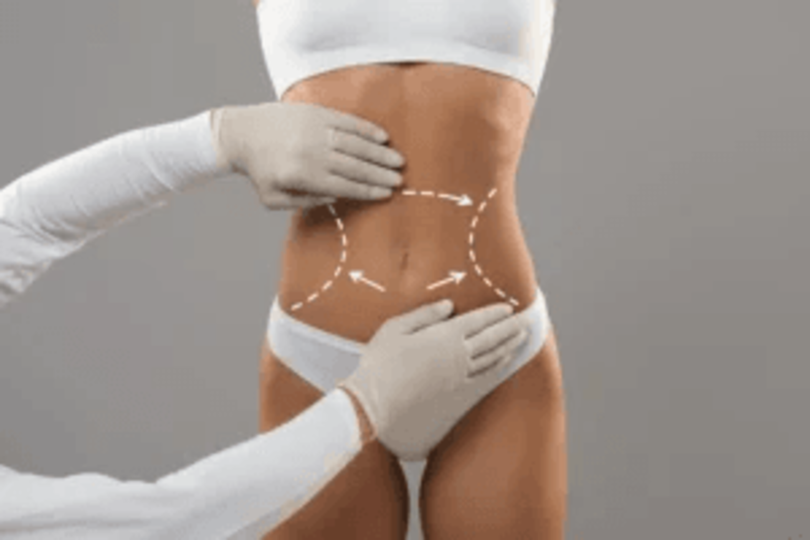 The Comprehensive Guide to Non-Surgical Body Contouring at Nava Wellness